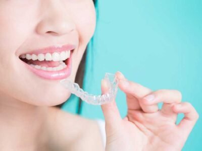 How Fast Does Invisalign Work? The Invisalign Process Explained