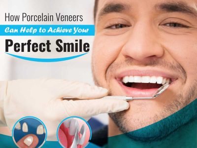 Why Veneers are the Answer to Having a Perfect Smile