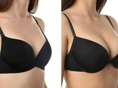 Get the Best Results From Your Breast Lift Surgery