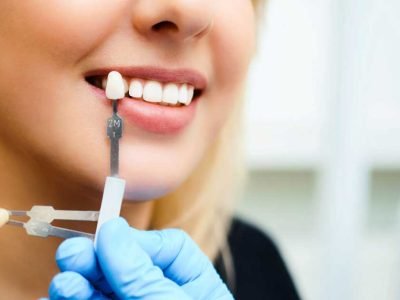 Getting Dental Implants In Etobicoke