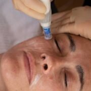Microneedling: The Signature of Salon Superiority